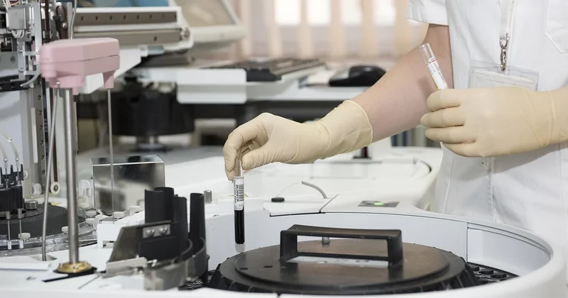 L'aide ASP n'est pas versée : l'arbre de diagnostic